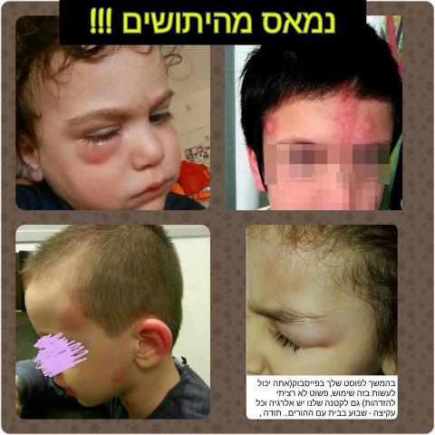 שכונת אם המושבות: מכת היתושים נמשכת - חדשות בפתח תקווה