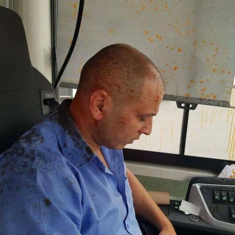 2 חשודים בני 22 מראש העין נחקרו במשטרה בנוגע לתקיפת נהג האוטובוס בצומת ירקונים באמצעות גז פלפל - חדשות בפתח תקווה