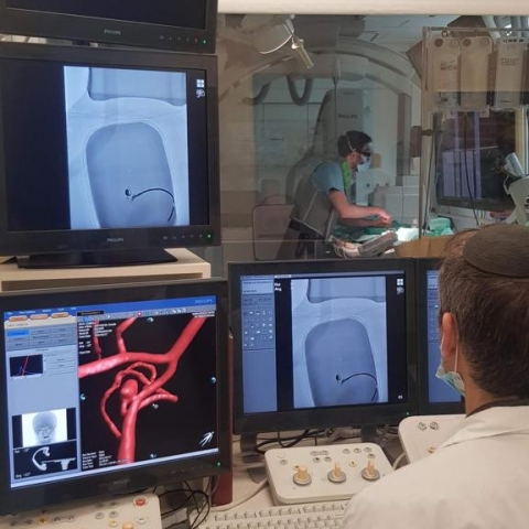 במערך החדשנות בבילינסון הדפיסו מודל מוח בתלת מימד - בריאות בפתח תקווה