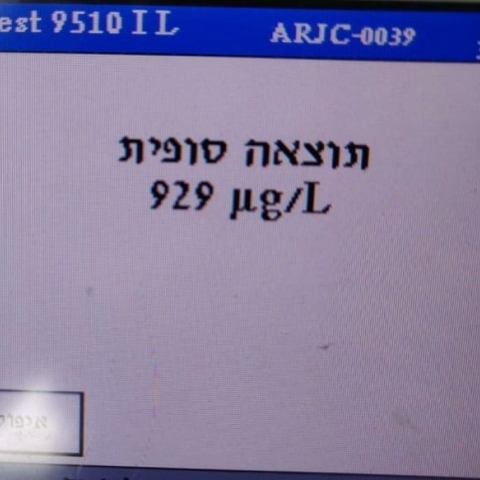 הלילה נלכדו, נהג בשכרות ושימוש בטלפון, 7 רכבים הורדו מהכביש ועוד - חדשות בפתח תקווה