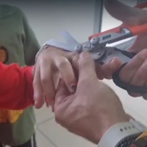 טבעת נתקעה באצבע שהחלה להכחיל - חדשות בפתח תקווה