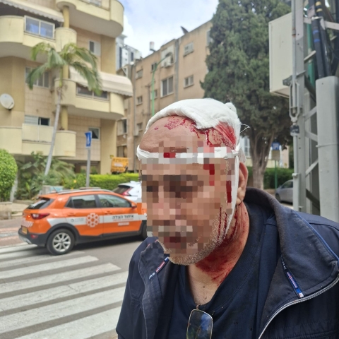 נערים תקפו אדם מבוגר ונמלטו - חדשות בפתח תקווה