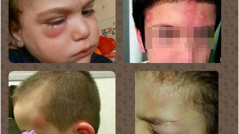 שכונת אם המושבות: מכת היתושים - חדשות בפתח תקווה