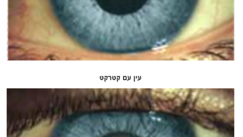 בן 50 הגיע לבדיקה והסתבר - בריאות בפתח תקווה