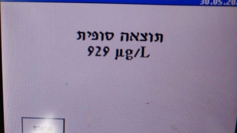 הלילה נלכדו, נהג בשכרות ושימוש - חדשות בפתח תקווה
