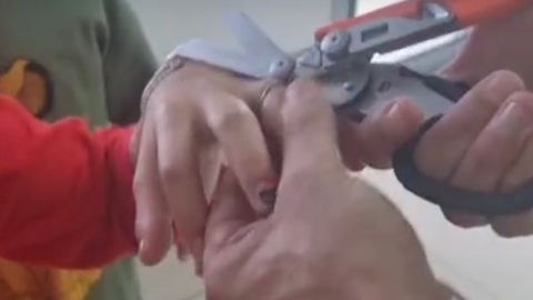 טבעת נתקעה באצבע שהחלה להכחיל - חדשות בפתח תקווה