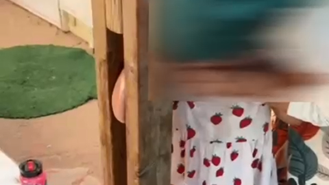 ידה של ילדה נלכדה במתקן - חדשות בפתח תקווה