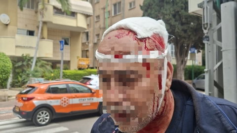 נערים תקפו אדם מבוגר ונמלטו - חדשות בפתח תקווה
